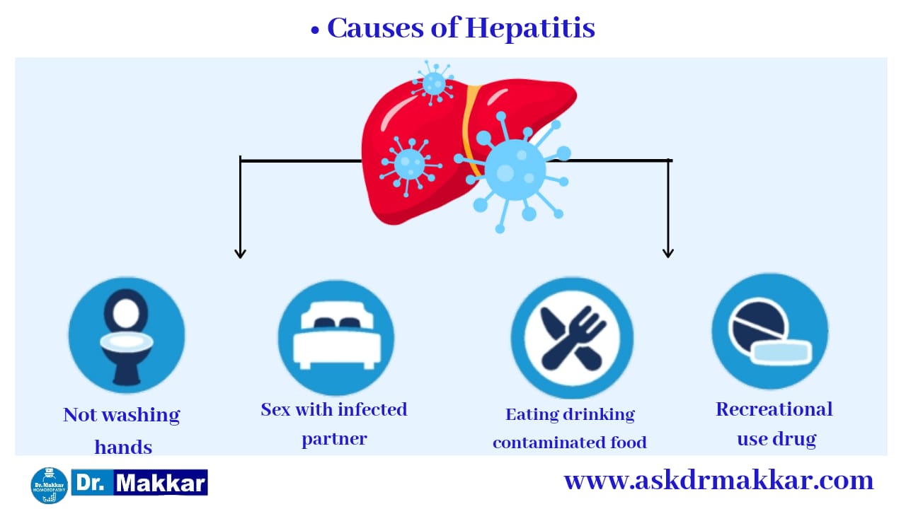 Hepatitis B Liver Cirrhosis Homeopathic Treatment India